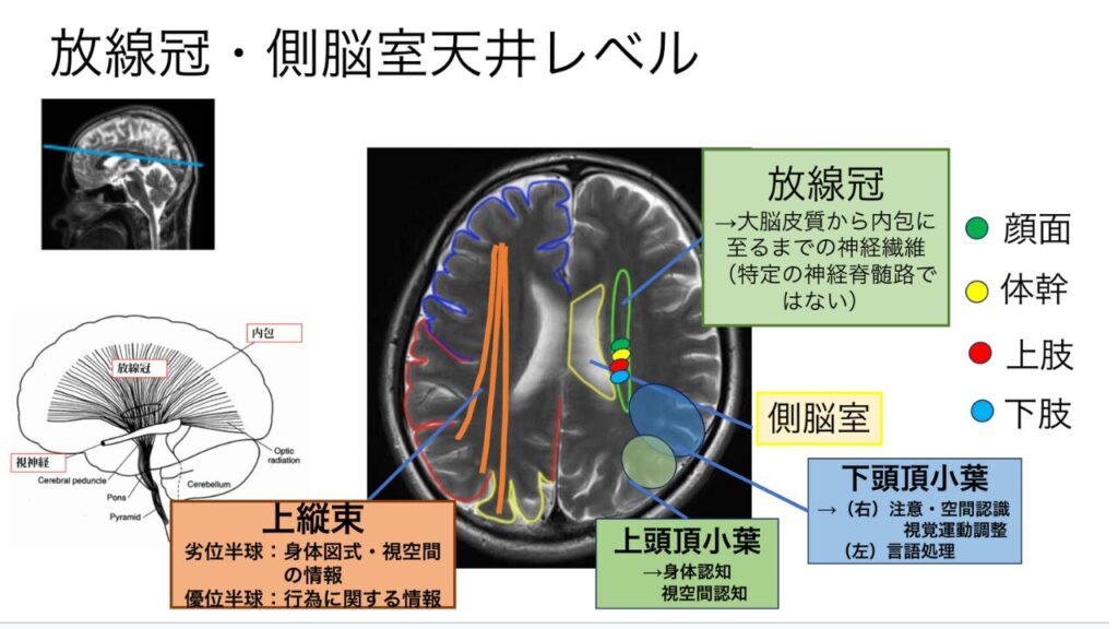 脳画像