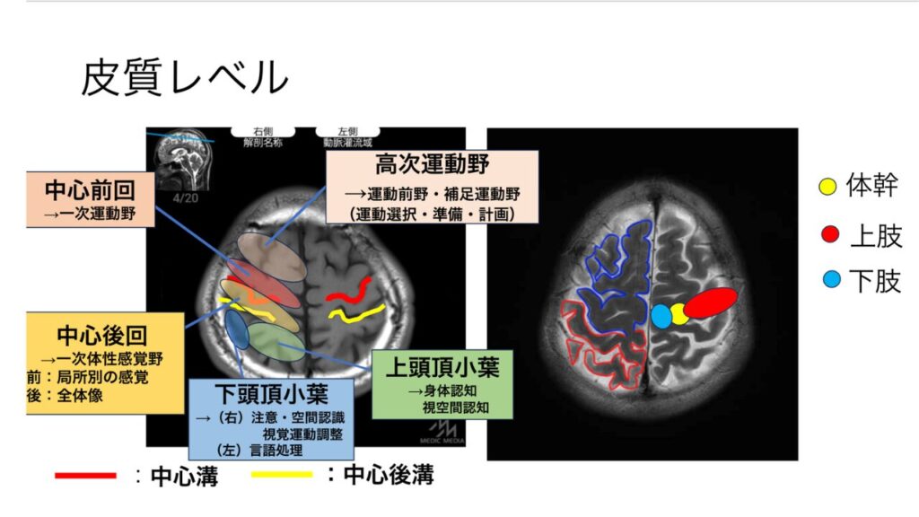 脳画像