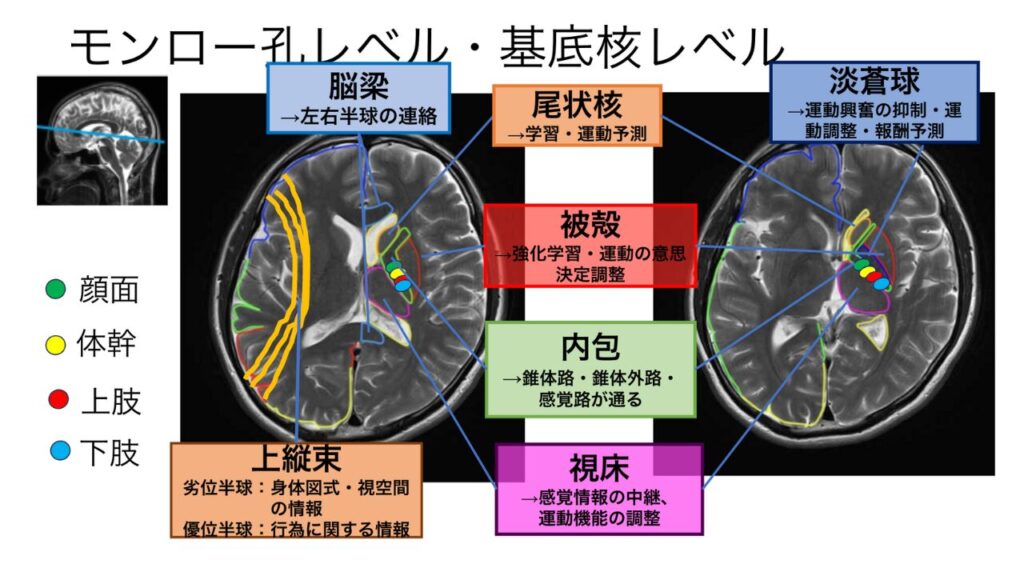 脳画像