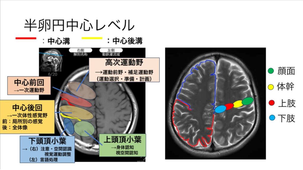 脳画像